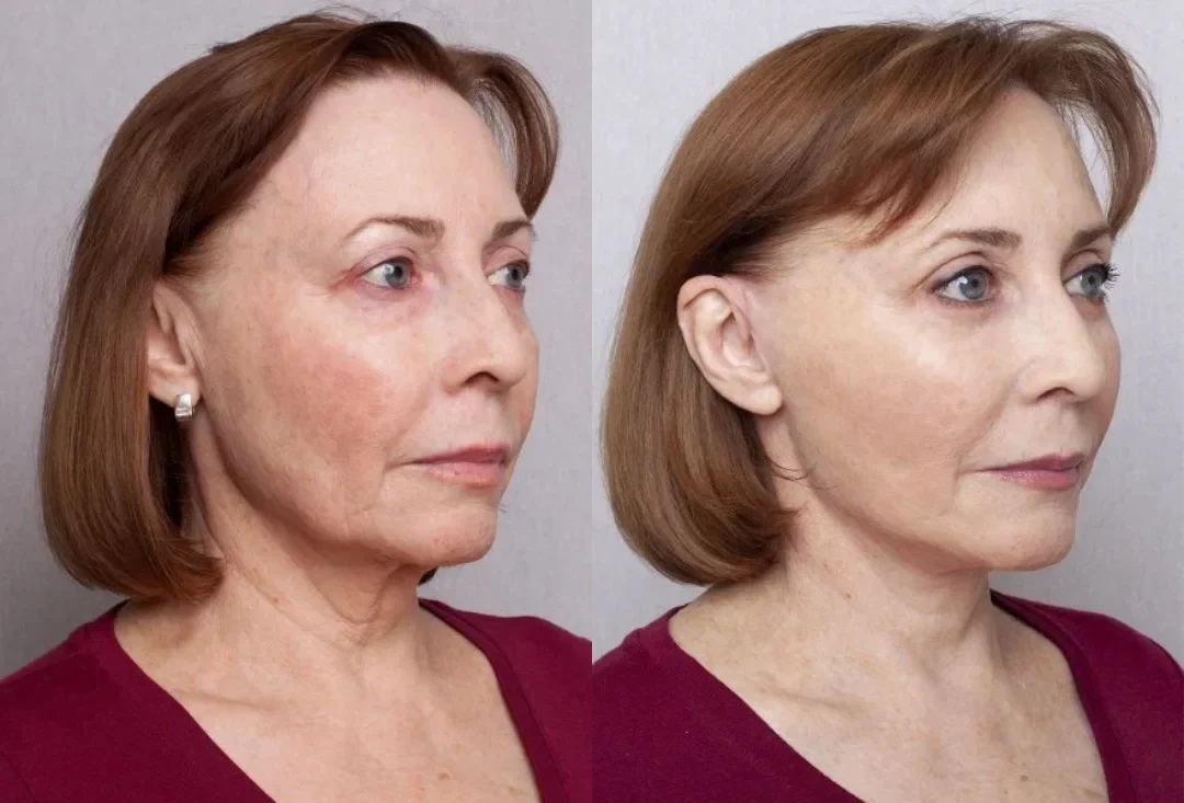 Velluria-Serum-33-e1744845751542.webp